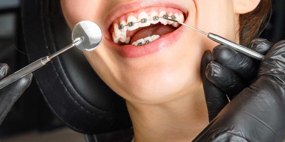 Are-Braces-Tax-Deductible-Understanding-Medical-Expense-Deductions